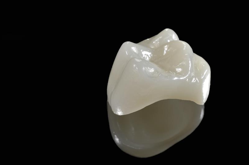 Lost Crowns or Fillings Emergency Dental Ahwatukee Foothills, AZ